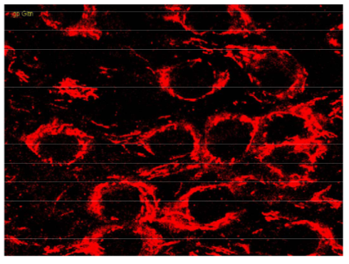 Glutaminase polyclonal antibody (GP)