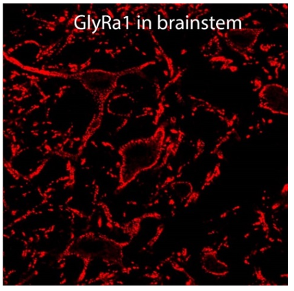 GlyRa1 polyclonal antibody (Rb)
