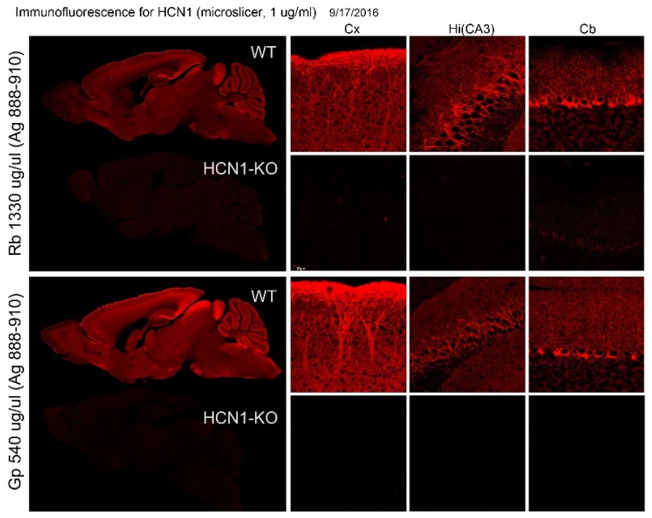 HCN1 polyclonal antibody (GP)