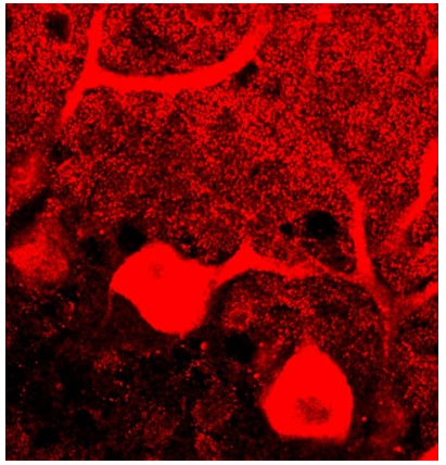 Homer 1 polyclonal antibody (Go)