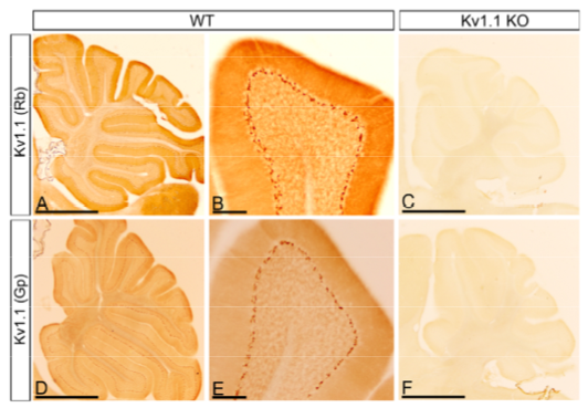 Kv1.1 polyclonal antibody (GP)