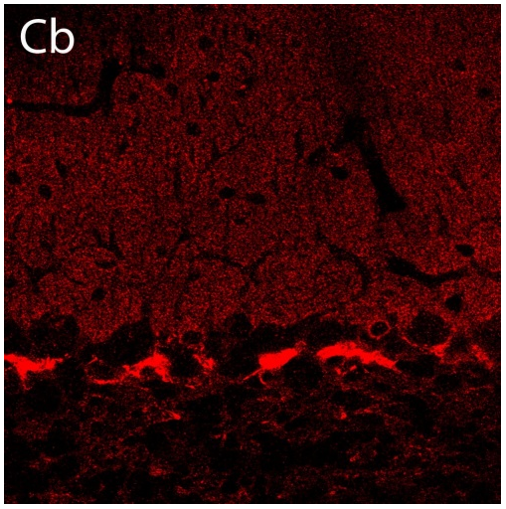 Kv1.2 polyclonal antibody (Rb)