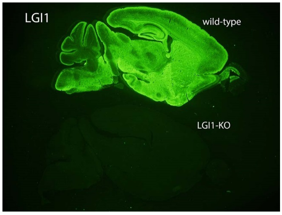LGI1 polyclonal antibody (GP)