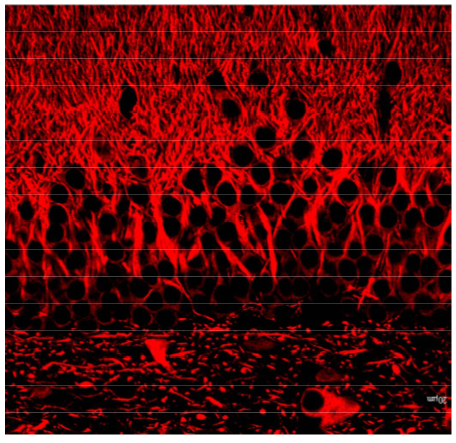 Anti MAP2 polyclonal antibody