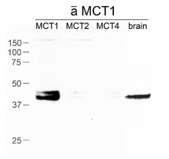 MCT1 polyclonal antibody (GP)