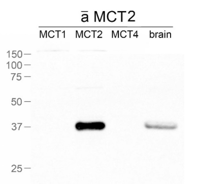 MCT2 polyclonal antibody (Rb)