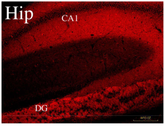 NAPE-PLD polyclonal antibody (GP)