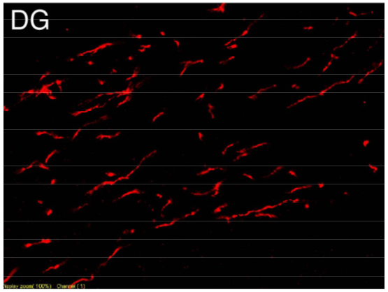 NET polyclonal antibody (GP)