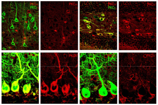 PKC? polyclonal antibody (GP)