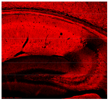 PKC?II polyclonal antibody (Rb)