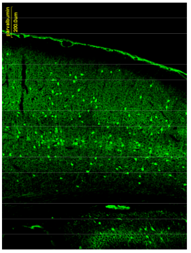 PV (parvalbumin) polyclonal antibody (Go)