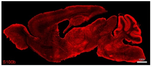 S100beta polyclonal antibody (Rb)