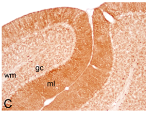 SK2 polyclonal antibody (Rb)