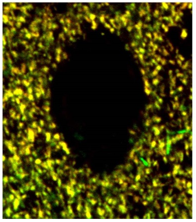 Synaptophysin polyclonal antibody (Go)
