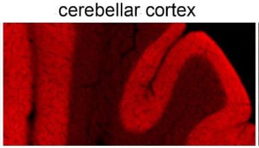 VDCCa1A (Cav2.1) polyclonal antibody (GP)