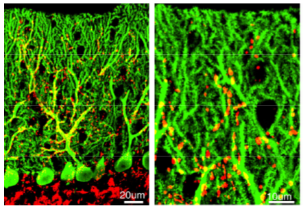 VGluT2 polyclonal antibody (Rb)