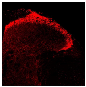 VR1 (TRPV1) polyclonal antibody (GP)