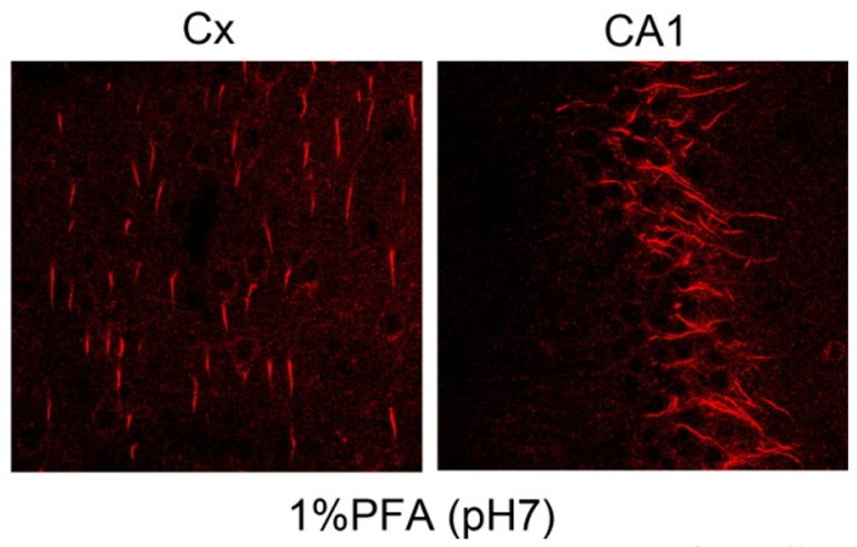 Ank-G (Ankirin-G) polyclonal antibody (GP)