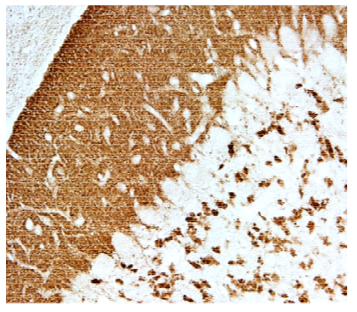 VGluT1 polyclonal antibody (GP)