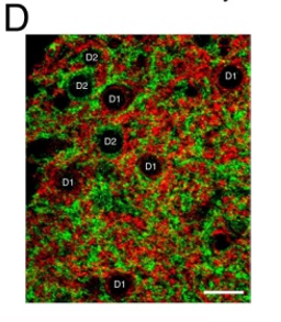 D2R (dopamine receptor-2) polyclonal antibody (GP)