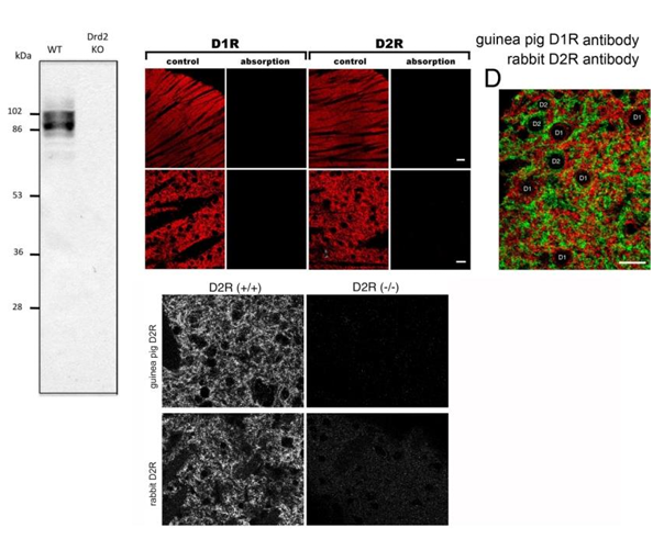 D2R (dopamine receptor-2) polyclonal antibody (GP)