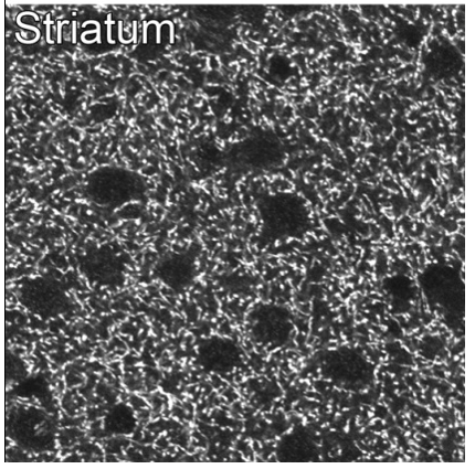 VMAT2 polyclonal antibody (Rb)